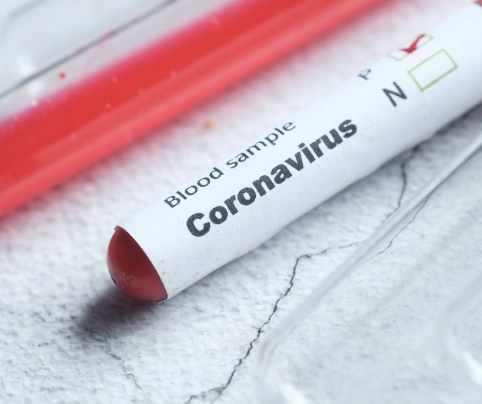 lo que debe saber para solicitar una prueba PCR-RT en Clínica Internacional.Cienfuegos.Cuba lo que debe saber para solicitar una prueba PCR-RT en Clínica Internacional.Cienfuegos.Cuba